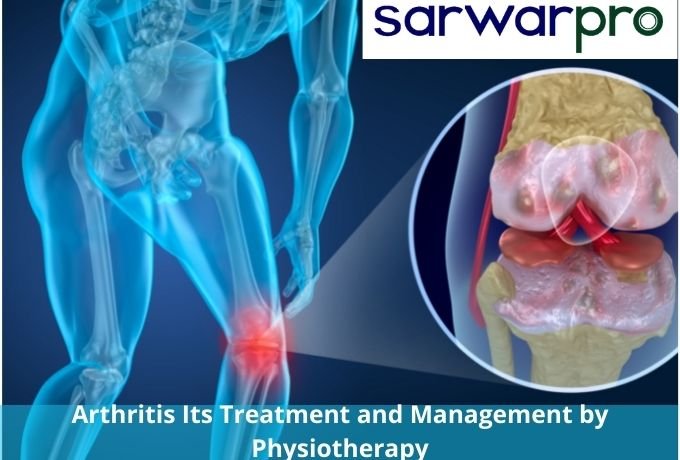 71122arthritis-its-treatment-and-management-by-physiotherapy.jpg