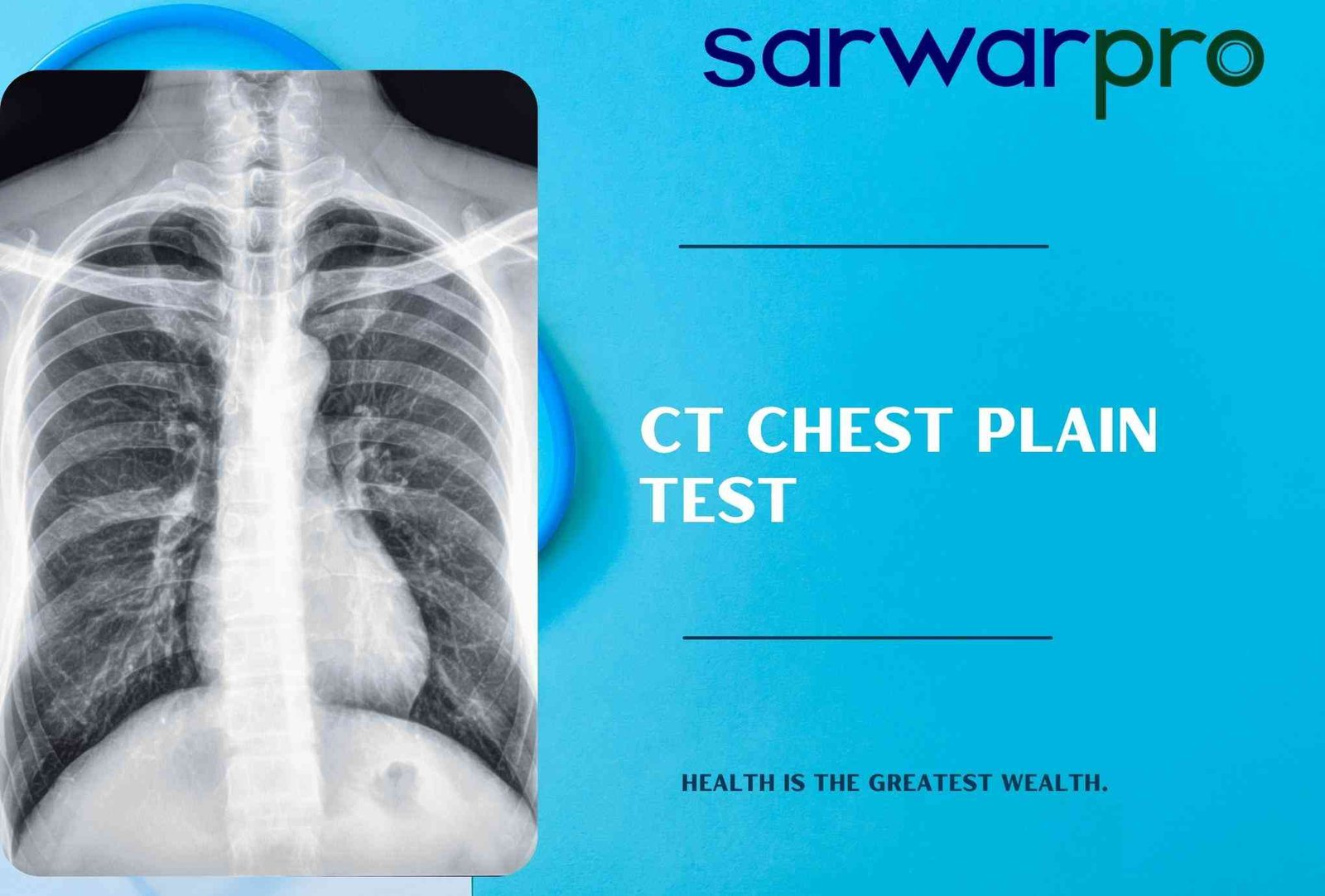 15359ct-chest-plain-test.jpg
