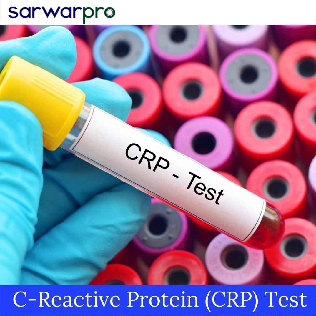 71692c-reactive-protein-(crp)-teast.jpg
